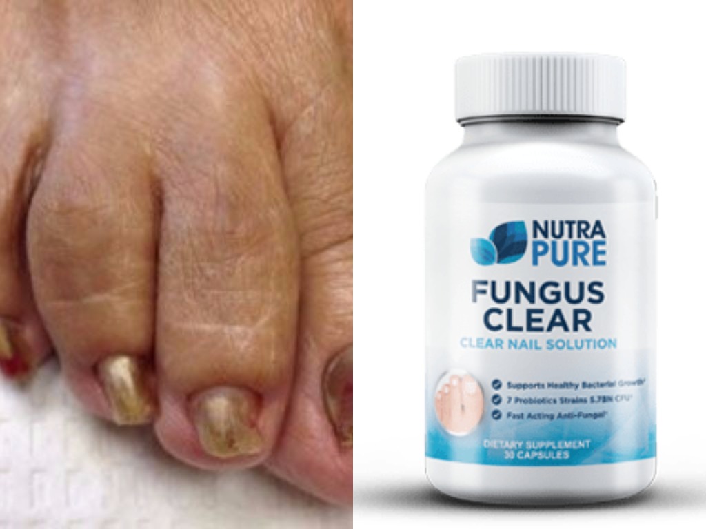 NutraPure Clear Fungus Review